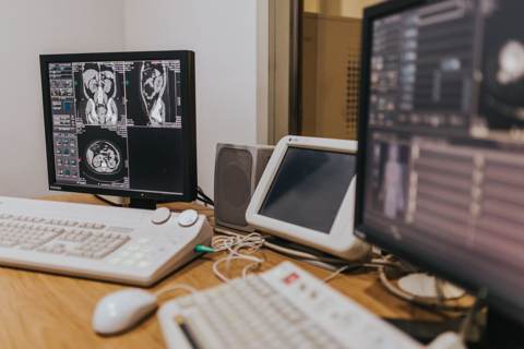 Mesothelioma Diagnosis: What Symptoms and Tests to Expect